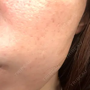 Chloe Cheongdam Clinic （クロエチョンダムクリニック）口コミ