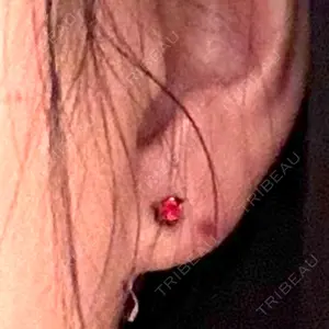 新宿ラクル美容外科クリニック 新宿ラクル美容外科クリニック 六本木院口コミ