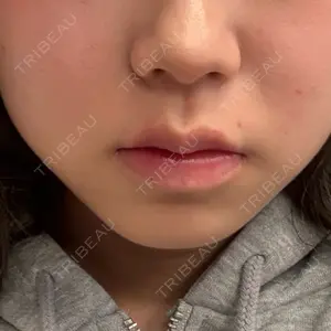 BiBiクリニック口コミ