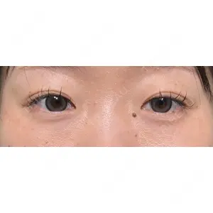 HAAB×DREAM BEAUTY CLINIC 大阪梅田院の