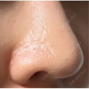 クレオビューティークリニック口コミ