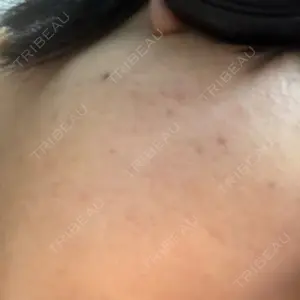 やさしい美容皮膚科・皮フ科 やさしい美容皮膚科・皮フ科　秋葉原院口コミ