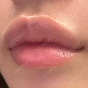 ルラ美容クリニック ルラ美容クリニック 大阪本院口コミ