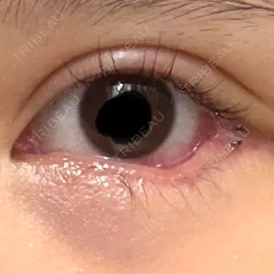 LOUIS CLINIC 二子玉川院【ルイクリニック】口コミ