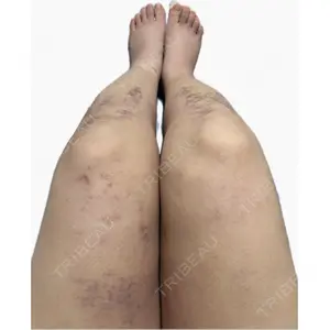 Lipo Clinic omotesando口コミ
