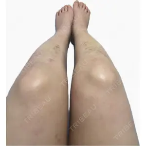 Lipo Clinic omotesando口コミ