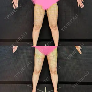 Lipo Clinic omotesando口コミ