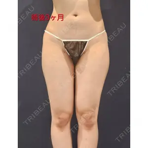 S.T styleクリニック口コミ