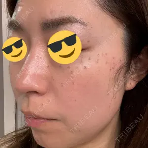 東京シルククリニック 東京シルククリニック 新宿院口コミ