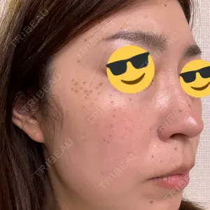 東京シルククリニック 東京シルククリニック 新宿院口コミ