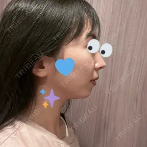 HINATA クリニック口コミ