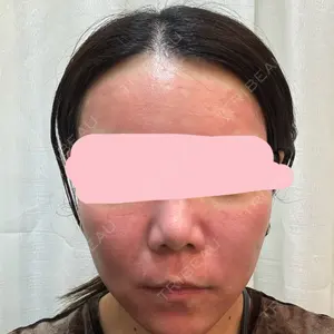 東京シルククリニック 東京シルククリニック 新宿院口コミ