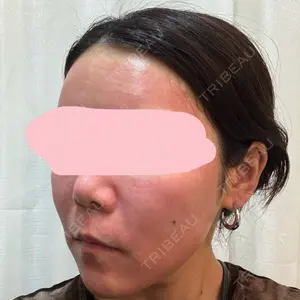 東京シルククリニック 東京シルククリニック 新宿院口コミ