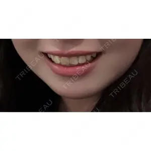 TCB東京中央美容外科 TCB東京中央美容外科 京都駅前院口コミ