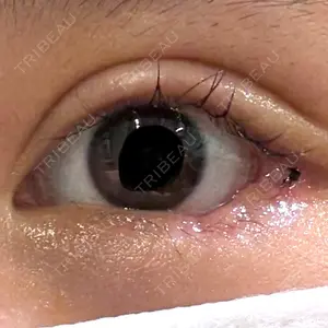 LOUIS CLINIC 二子玉川院【ルイクリニック】口コミ