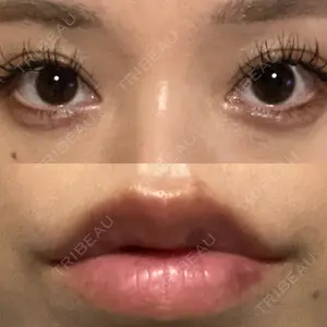 アリエル美容クリニック アリエル美容クリニック 水戸院口コミ