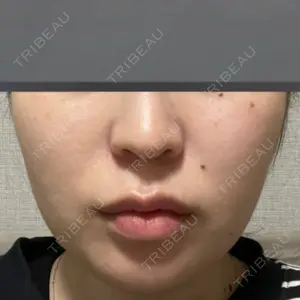 口コミ