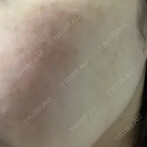 エースクリニック エースクリニック 大阪梅田HEPナビオ院口コミ