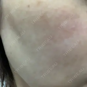 エースクリニック エースクリニック 大阪梅田HEPナビオ院口コミ