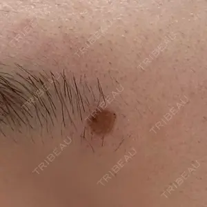 Fellez Clinic【フェルズクリニック】口コミ