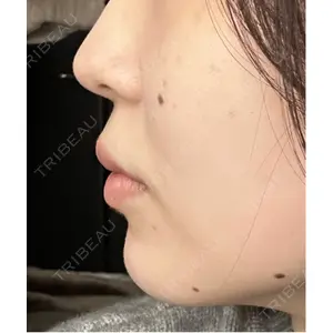 プロクリニック PRO CLINIC プロクリニック 銀座院口コミ