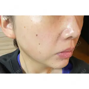 ルラ美容クリニック ルラ美容クリニック 千葉院 / ルラスキンクリニック 千葉院口コミ