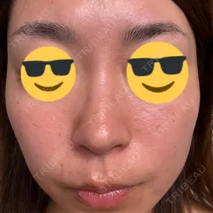 東京シルククリニック 東京シルククリニック 新宿院口コミ