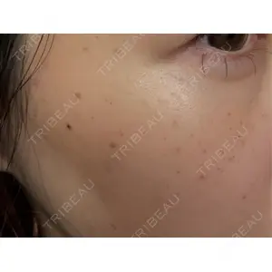 ルラ美容クリニック ルラ美容クリニック 広島院口コミ