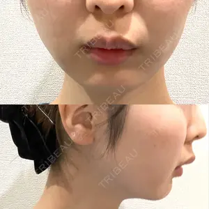 GAYA body design clinic口コミ