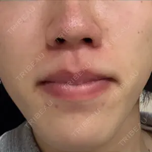 APスキンクリニック銀座の