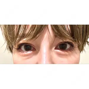 新宿Ladies&Gentlemen美容クリニック口コミ