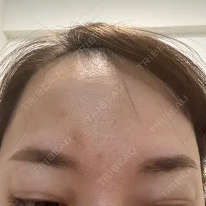 TCB東京中央美容外科 TCB東京中央美容外科 千葉駅前院口コミ