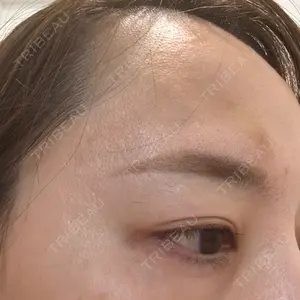 TCB東京中央美容外科 TCB東京中央美容外科 千葉駅前院口コミ