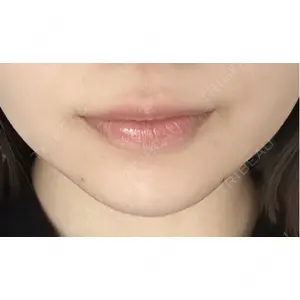 プロクリニック PRO CLINIC プロクリニック 銀座院口コミ