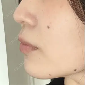 プロクリニック PRO CLINIC プロクリニック 銀座院口コミ