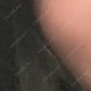 MKクリニック MKクリニック 日本橋院口コミ