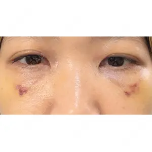 池袋麗歯科・美容皮膚科口コミ