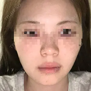 Nebula Clinic 小倉美容外科ネビュラクリニック口コミ