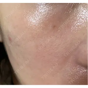 メディカルエピレーションクリニック メディカルエピレーションクリニック 心斎橋院口コミ