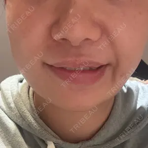 Nebula Clinic ネビュラクリニック 東京錦糸町院口コミ