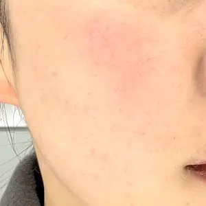 ルラ美容クリニック ルラ美容クリニック 仙台院 / ルラスキンクリニック 仙台院口コミ