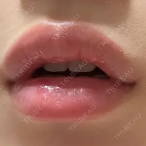 ルラ美容クリニック ルラ美容クリニック 大阪本院口コミ