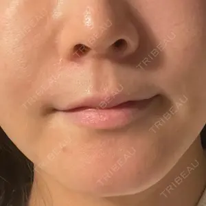 BAO CLINIC BAO CLINIC 心斎橋院口コミ