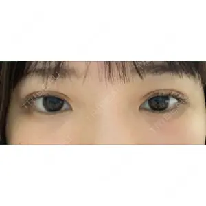 口コミ