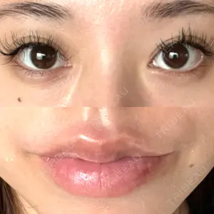 アリエル美容クリニック アリエル美容クリニック 水戸院口コミ