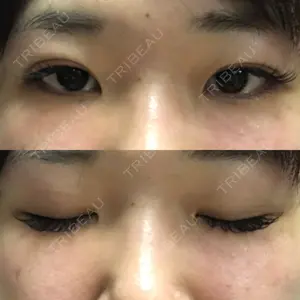 口コミ