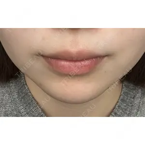 プロクリニック PRO CLINIC プロクリニック 銀座院口コミ