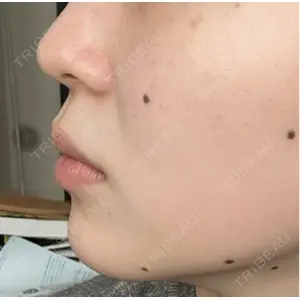 プロクリニック PRO CLINIC プロクリニック 銀座院口コミ