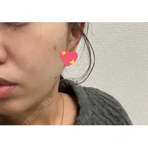 ルラ美容クリニック ルラ美容クリニック 大阪心斎橋院口コミ