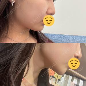 エースクリニック エースクリニック 大阪梅田HEPナビオ院口コミ